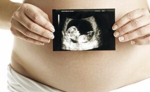 cuándo acudir al médico en el embarazo